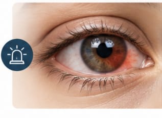 Urgences ophtalmologiques